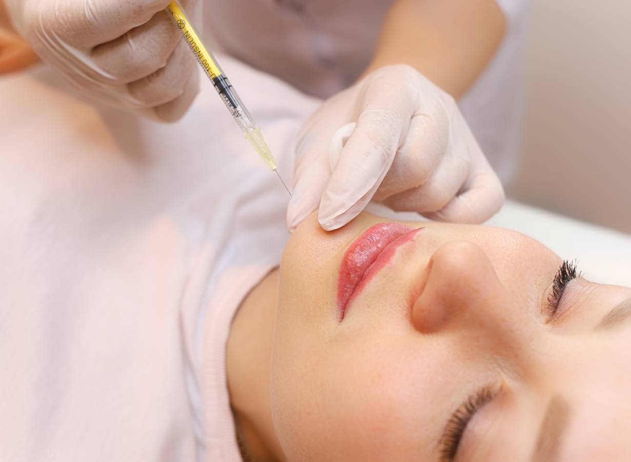 what are the newest trends in dermal fillers