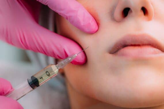 how long do the results of different fillers typically last