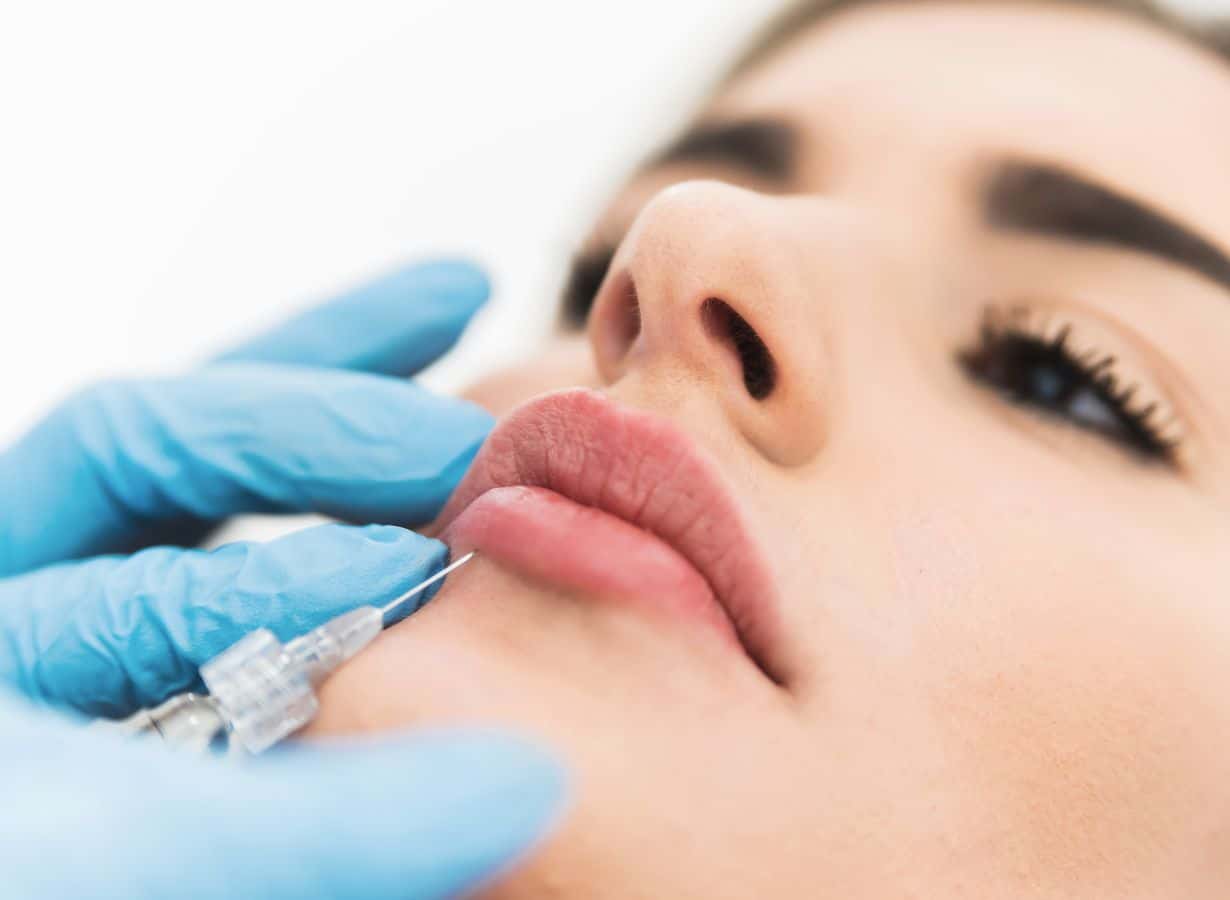 what is the recovery process like after receiving dermal fillers